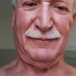 Uomo 78 anni di Napoli bianco